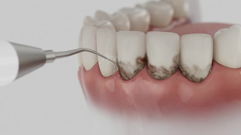 Reliable Dental Implants contractor in Wye, MT by Smile Center Dentistry